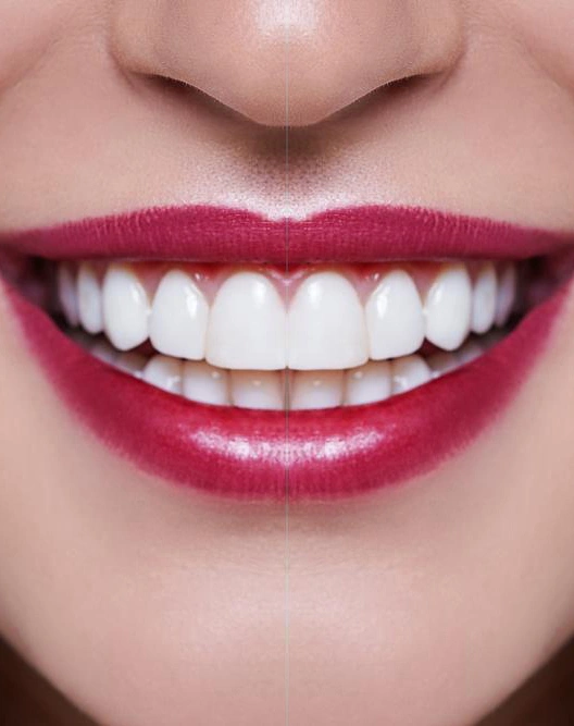 teeth01 teeth01